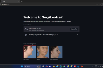 Deep Plastic Surgery - Surgilook.ai