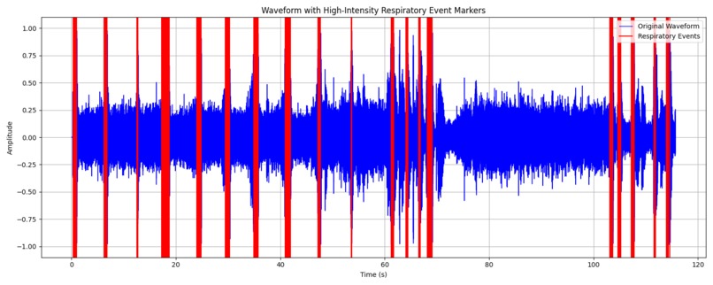 BreatheWell Sleep Apnea Detection with Voice Recognition – screenshot 1