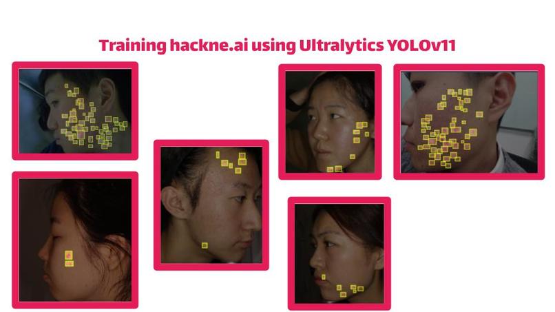 hackne.ai – screenshot 3