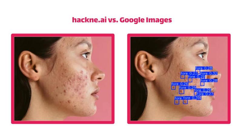 hackne.ai – screenshot 4