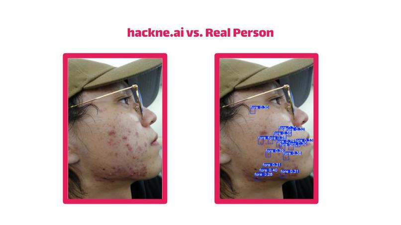 hackne.ai – screenshot 6