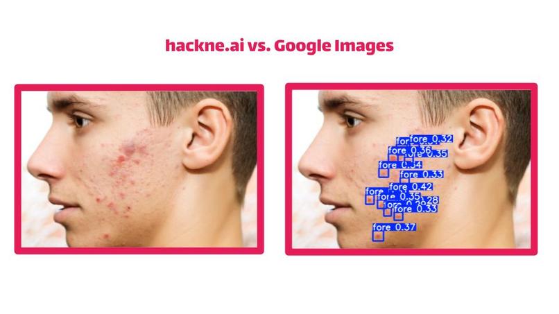 hackne.ai – screenshot 5