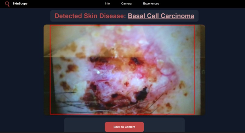 SkinScope – screenshot 3
