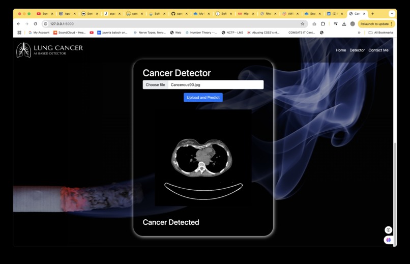 LUNGGUARD: AI-Powered Lung Cancer Detection – screenshot 2