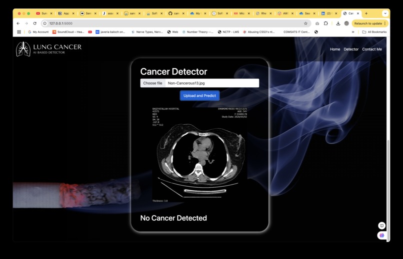LUNGGUARD: AI-Powered Lung Cancer Detection – screenshot 3