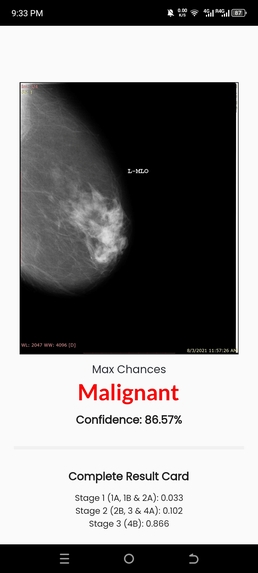 Breast Cancer – screenshot 5