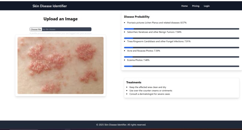 SkinDiseaseDetector – screenshot 2