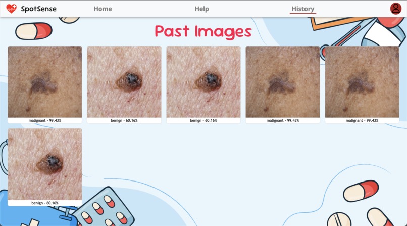 SpotSense – screenshot 4