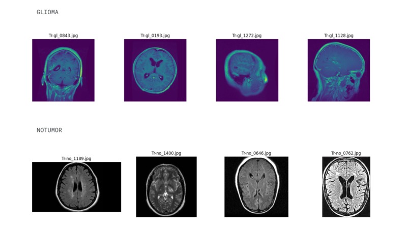 NeuroScope – screenshot 3
