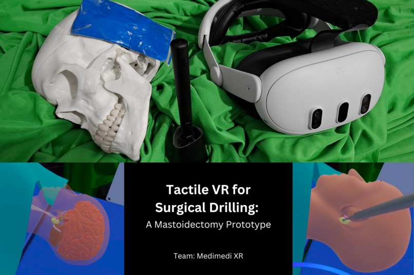 Tactile VR for Surgical Drilling: A Mastoidectomy Prototype – screenshot 1