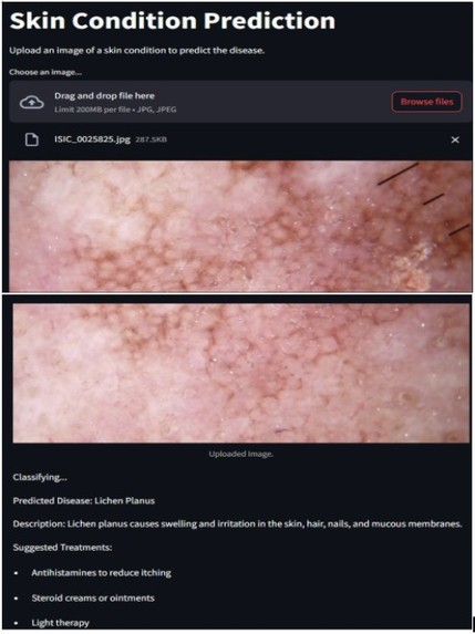 DermAi: AI-Powered Skin Disease Detection – screenshot 1