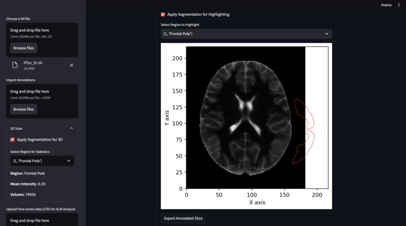NeuroX  – screenshot 4