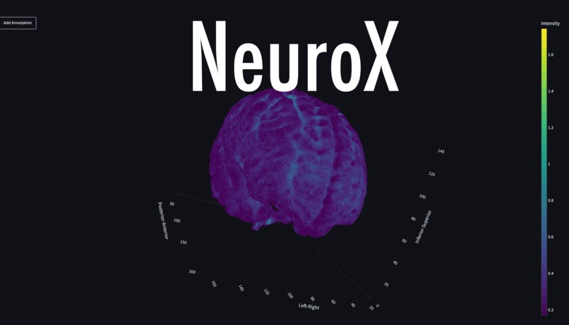 NeuroX  – screenshot 1