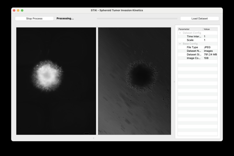 Spheroid Tumor Invasion Kinetics (STIK) GUI – screenshot 3