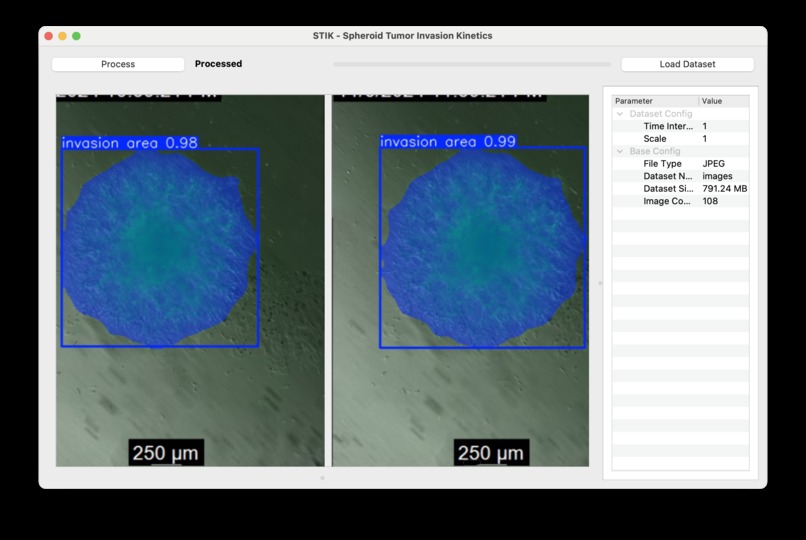 Spheroid Tumor Invasion Kinetics (STIK) GUI – screenshot 4