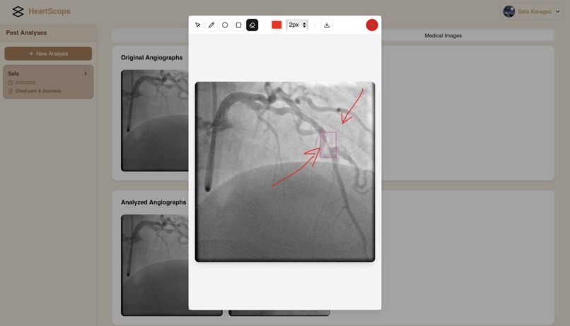 HeartScope – screenshot 9
