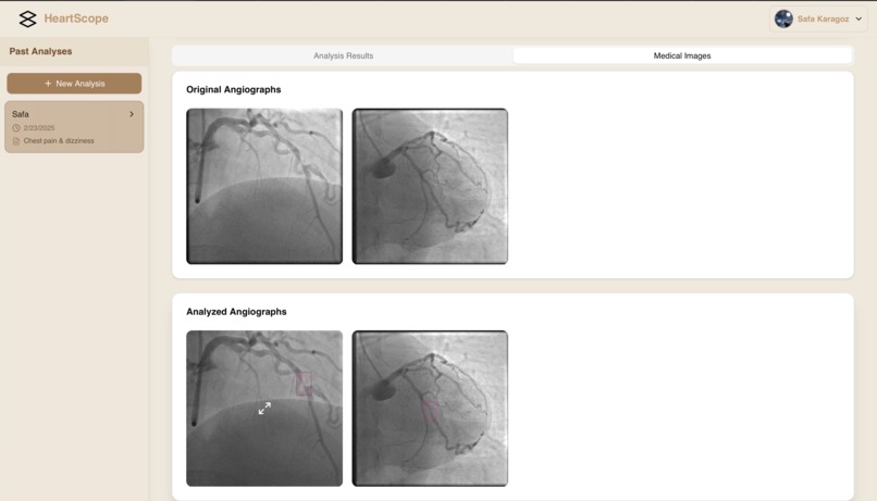HeartScope – screenshot 8