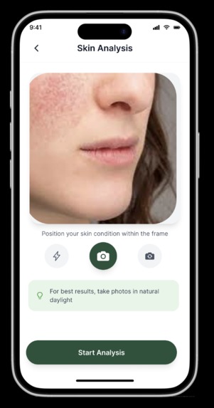 AyurDerm – screenshot 2