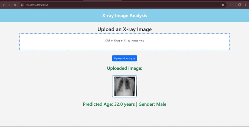 Age_Gender_by_XRay – screenshot 1