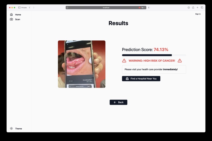 OncoVision – screenshot 2
