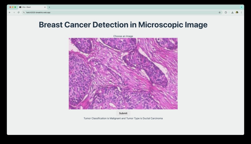 Breast Cancer Detection in Microscope Images – screenshot 1