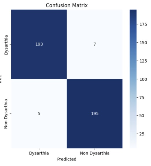 Dysarthria Speech Classifier – screenshot 2