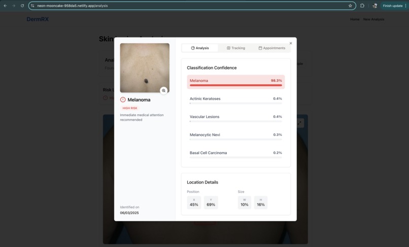 DermRX: AI-Powered Skin Cancer Detection Assistant – screenshot 3