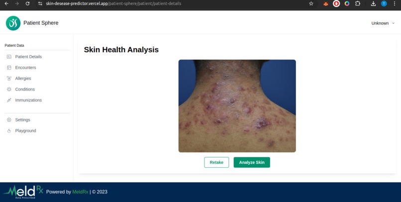 Skin Disease Predictor  – screenshot 5