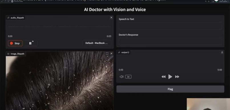 AI Medical Chatbot(with vision and voice) – screenshot 1