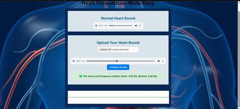 77- Heart Auscultations made easy – screenshot 1