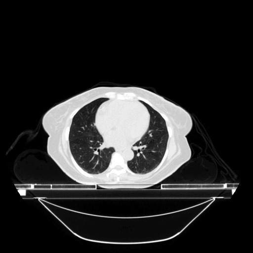 PancreAI – screenshot 3