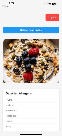 AllergenScan AI – screenshot 2
