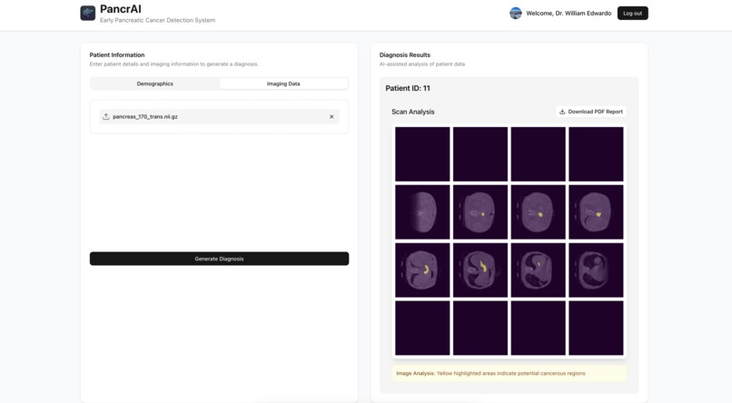 PancreAI – screenshot 2