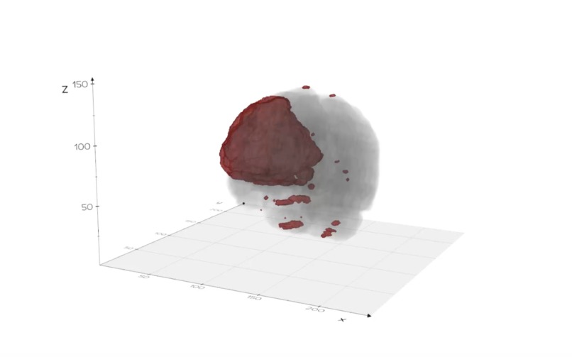 NeuronB: Medical Imaging Made Simple – screenshot 1