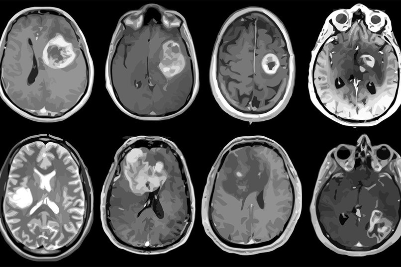 NeuronB: Medical Imaging Made Simple – screenshot 2