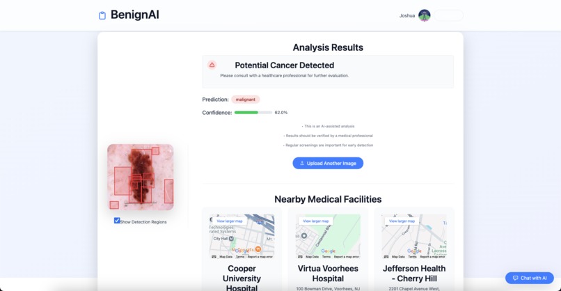 BenignAI – screenshot 2