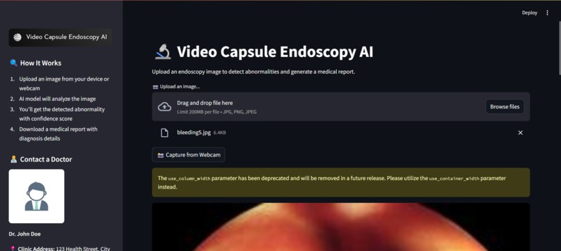 Video-Capsule-Endoscopy-Analysis – screenshot 1