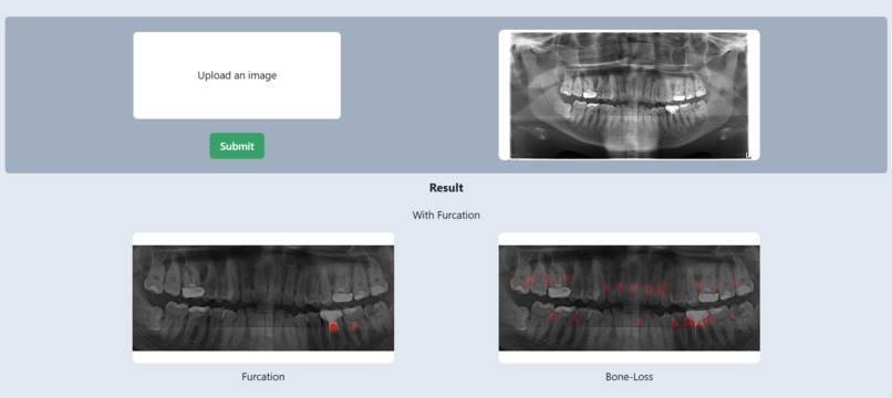 FurcaVision – screenshot 2