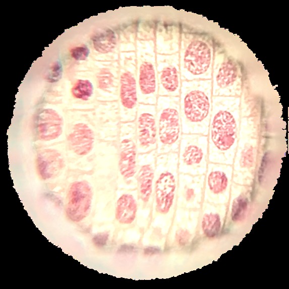 SkinSight AI – screenshot 1