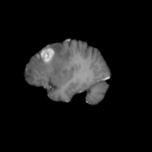 Brain Tumor Detection – screenshot 1