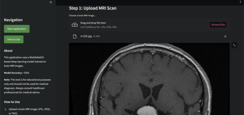 NeuroScan.AI – screenshot 2