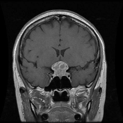 NeuroScan.AI – screenshot 7