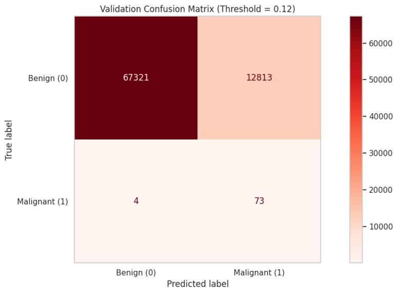 Melanoma Classification Model - ISIC Competition – screenshot 4