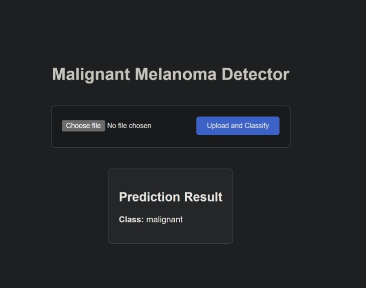 Malignant Melanoma Detector – screenshot 1