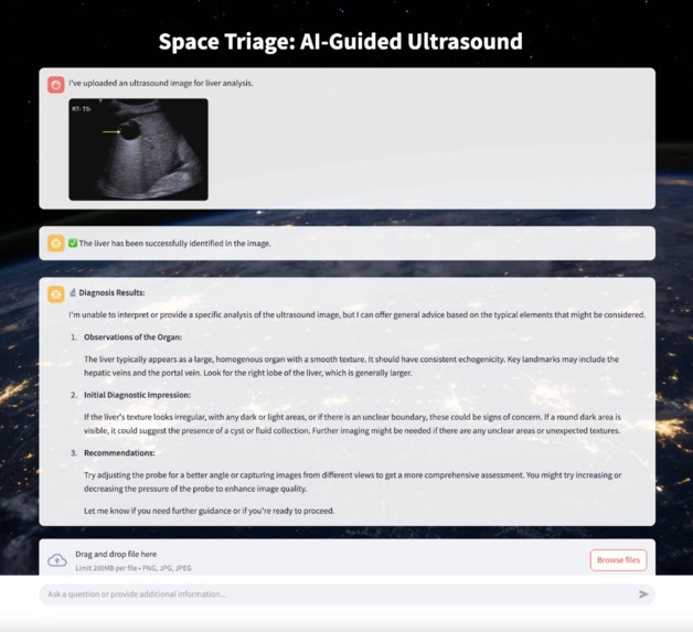 Space Triage: AI-Guided Ultrasound – screenshot 3
