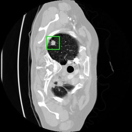 LUNG CANCER DETECTION AND ANALAYSIS WITH AI  – screenshot 6