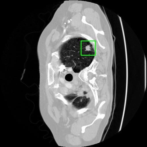 LUNG CANCER DETECTION AND ANALAYSIS WITH AI  – screenshot 7