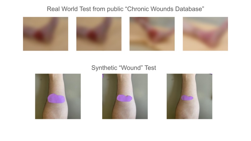 WoundWatch – screenshot 7