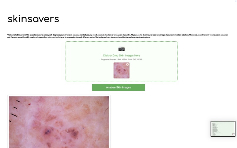 SkinSavers – screenshot 3