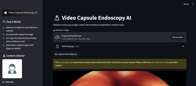 EndoScopeAI – screenshot 1